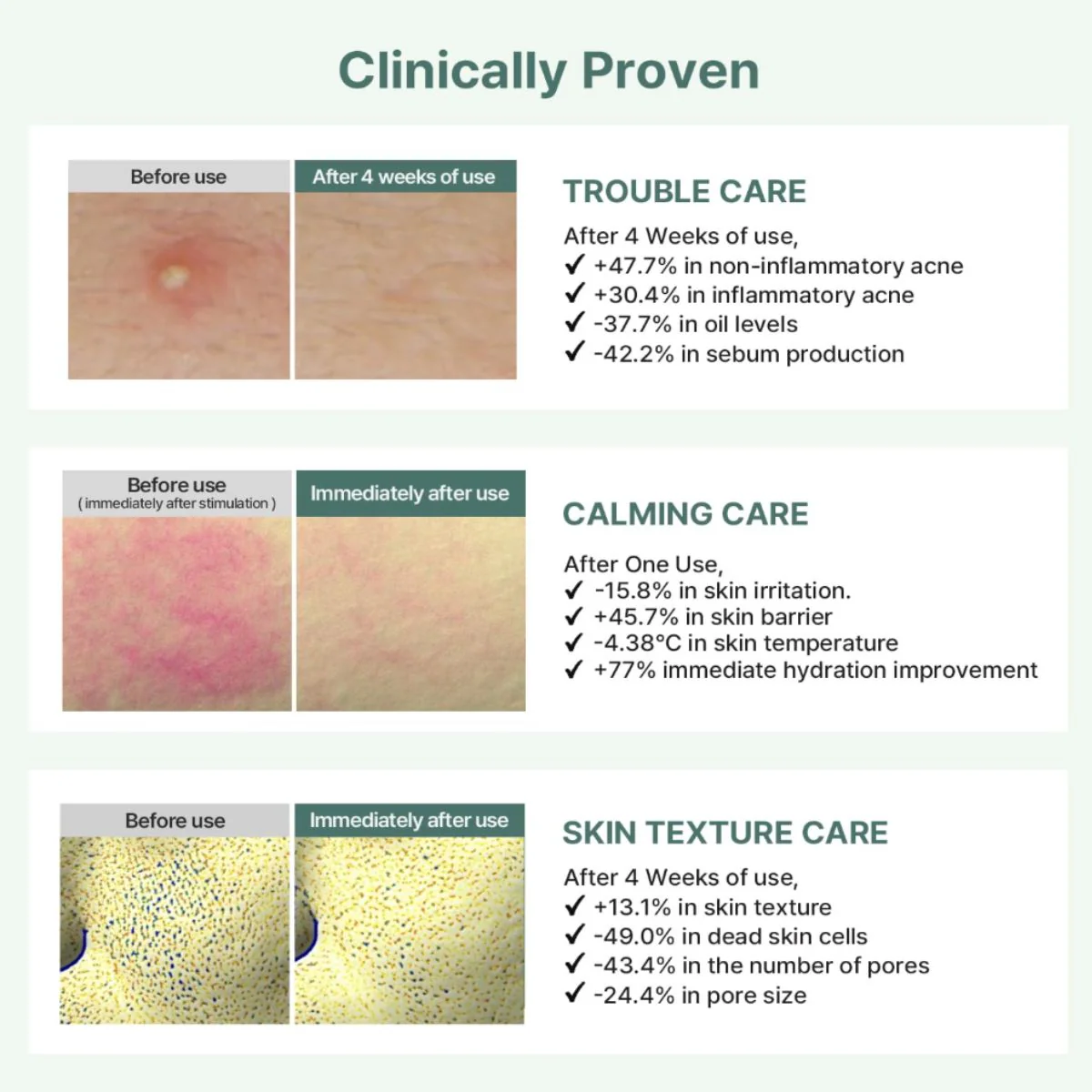 Cica Panthenol Mask - Image 5