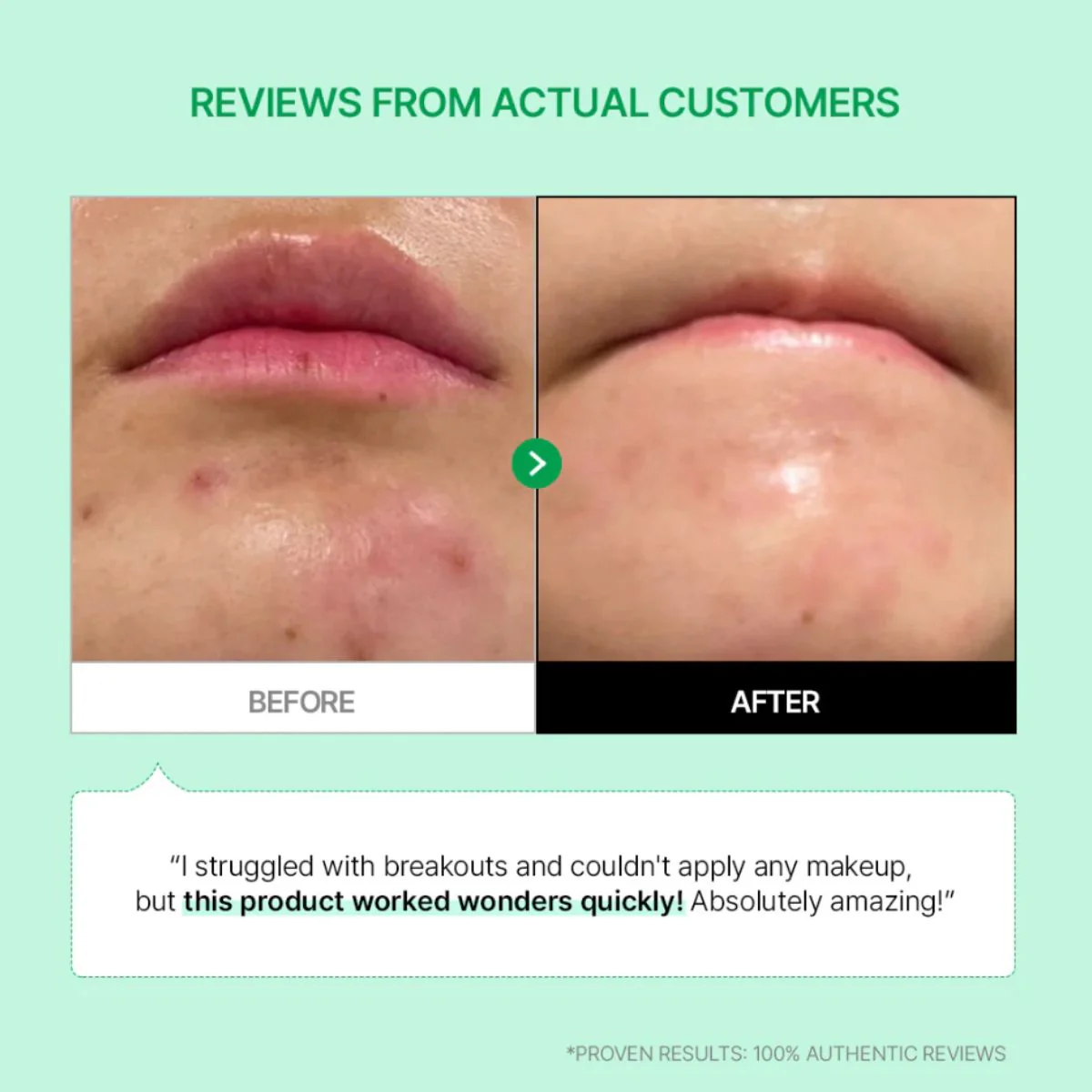 Cicamanu 92 Serum 30mL - Image 5
