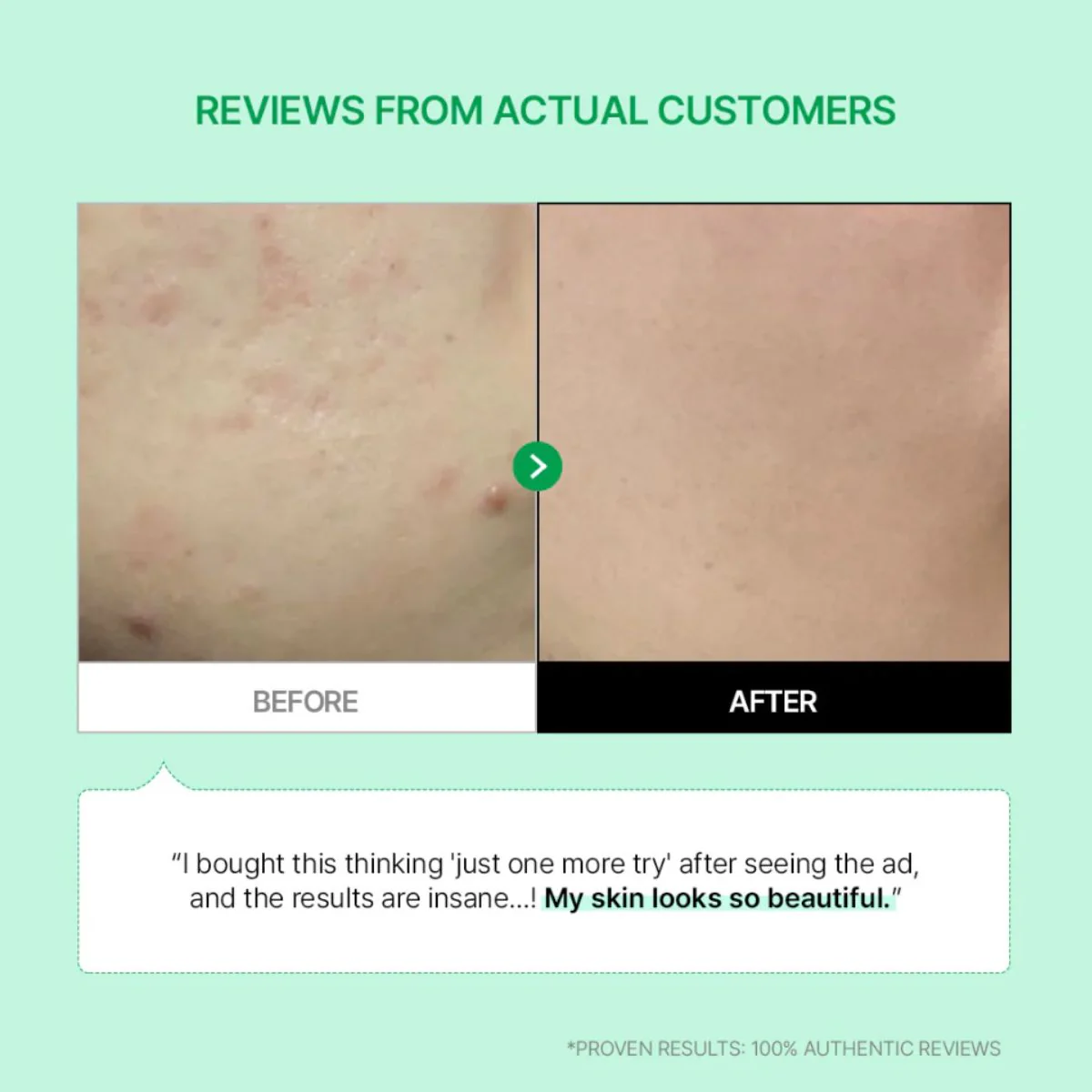 Cicamanu 92 Serum 30mL - Image 6