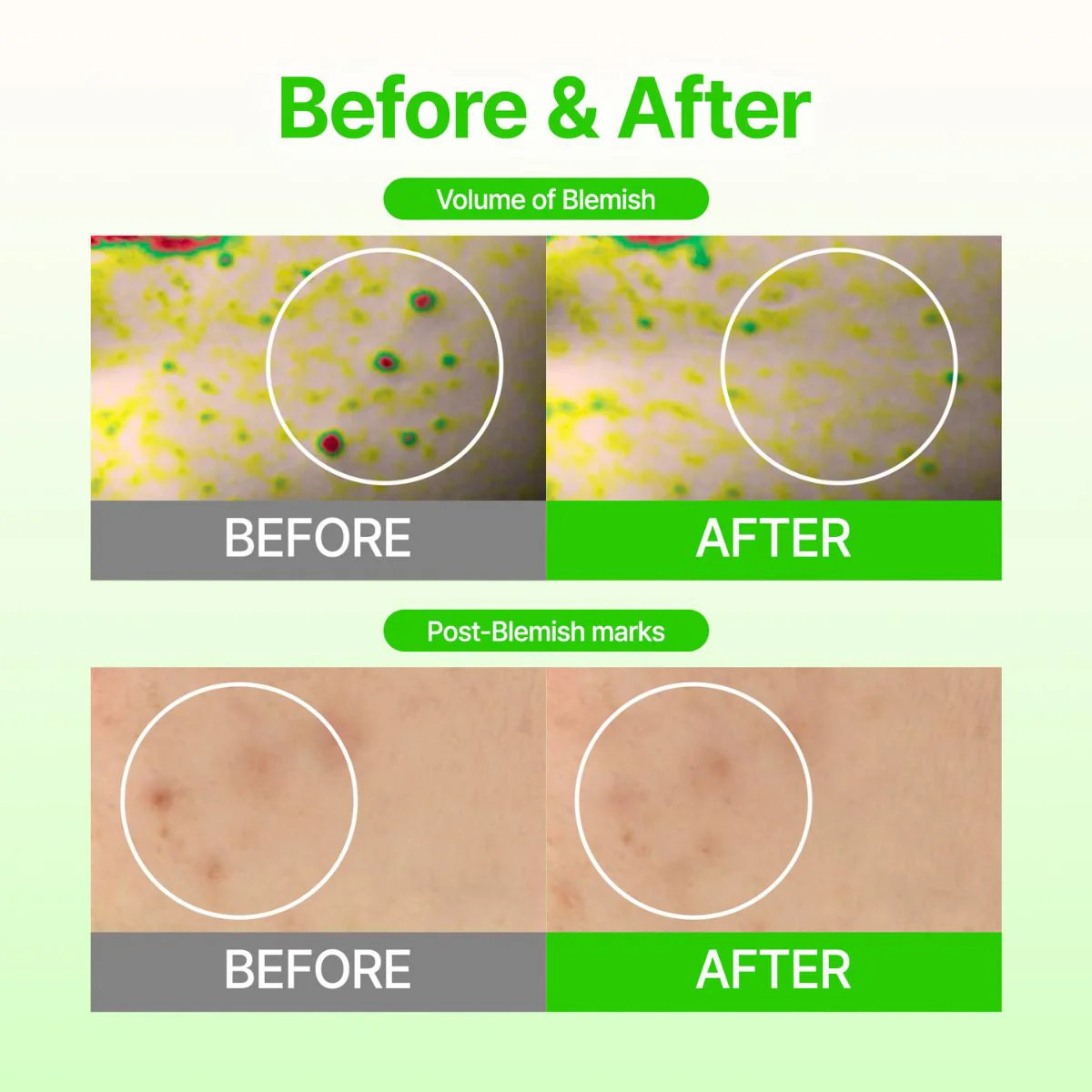 Dark Spot Care Microcone Patch (6 patches) - Image 5