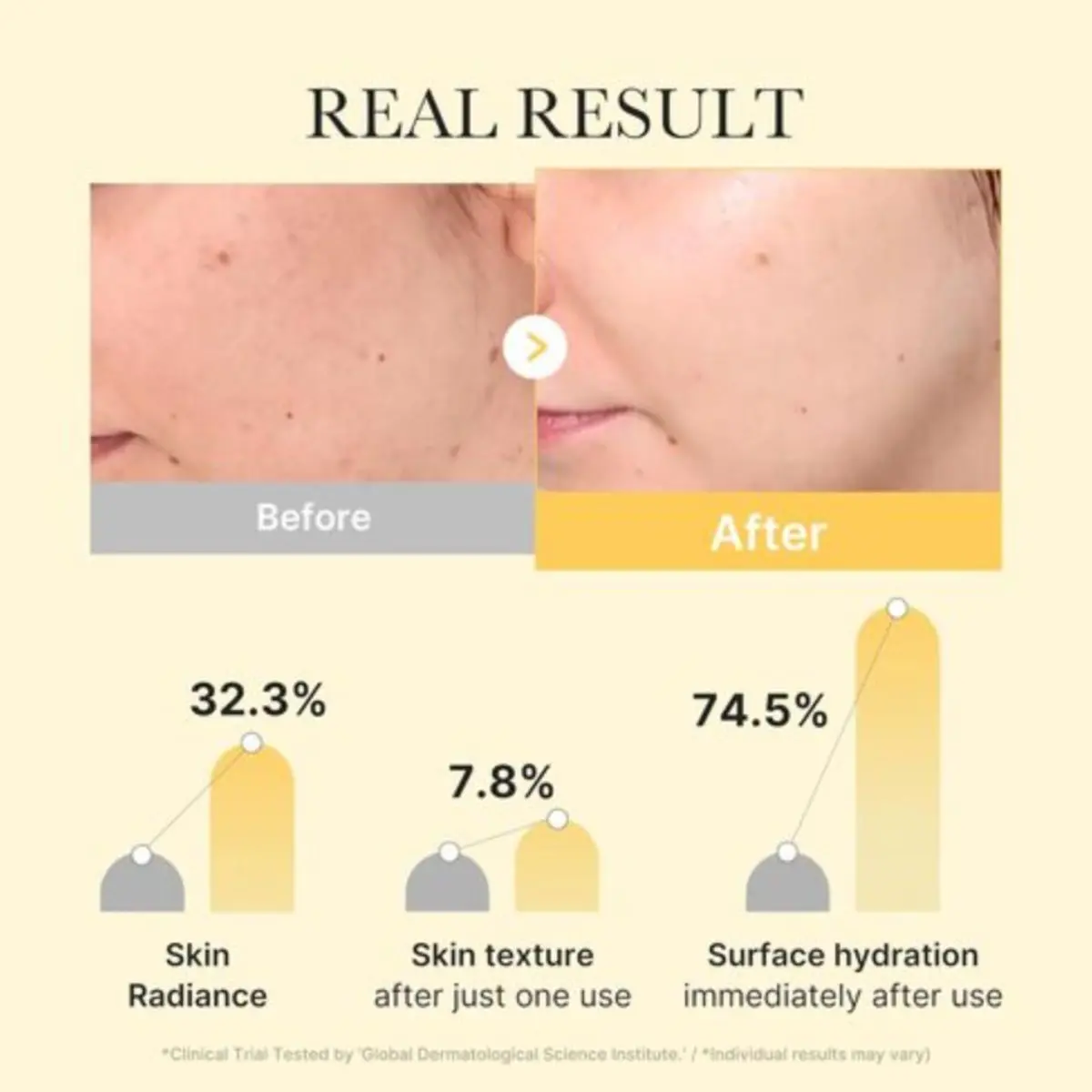 Kojic Acid Turmeric Brightening Gel Mask 4ea - Image 5