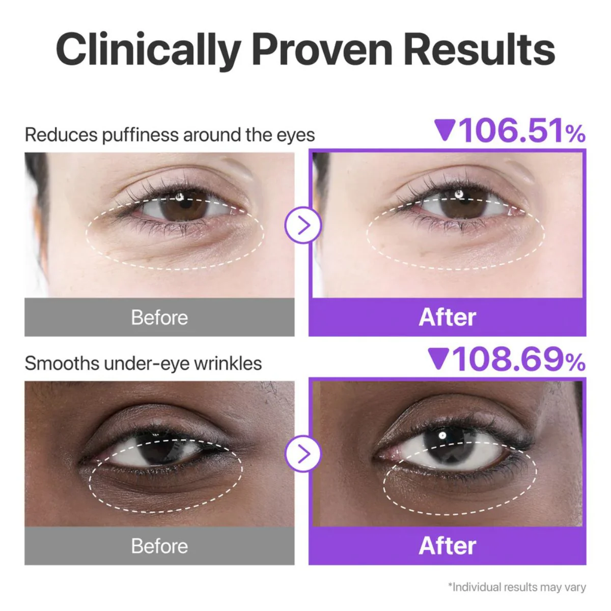No.9 NAD+ Collagen Under Eye Patches - Image 5