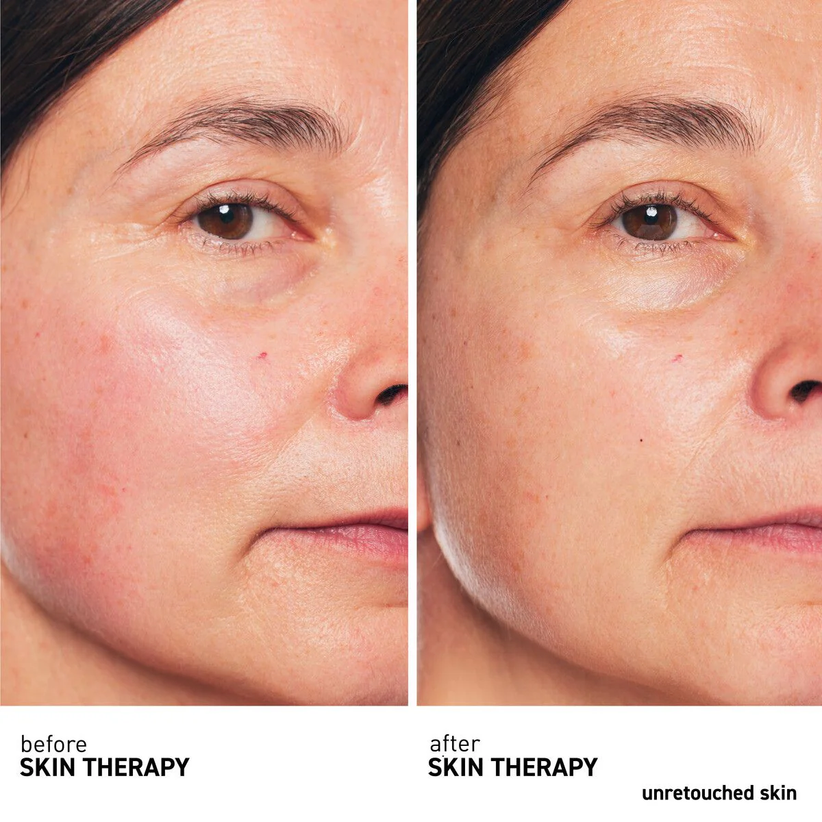 Skin Therapy 30mL - Image 4